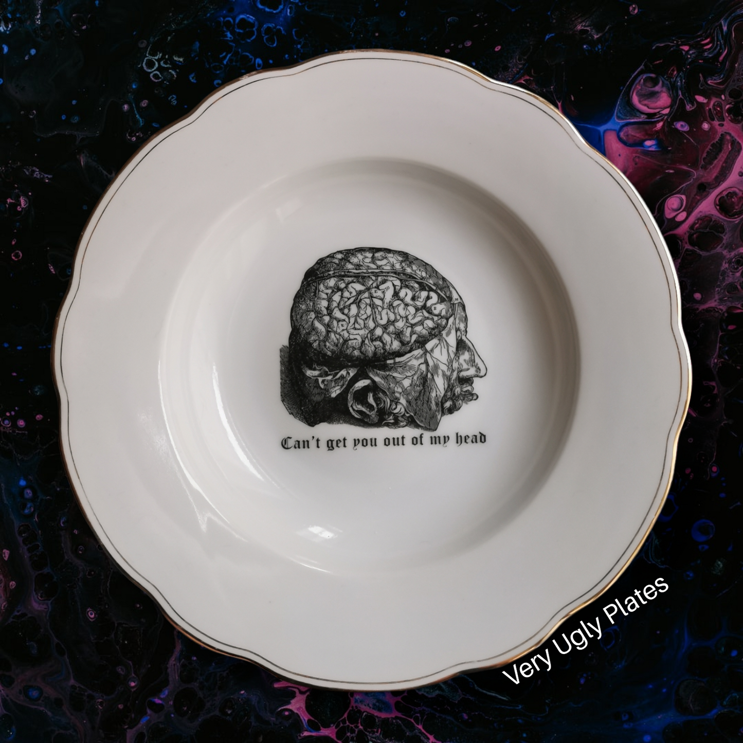 My head
